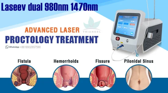 의사 추천 항문 누관 더미 치질 부비동 모소 수술 레이저 980nm 1470nm Triangelmed 항문 수술 의료 다이오드 레이저 기계