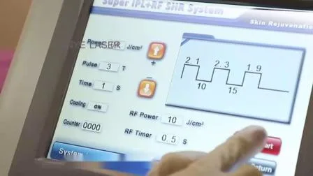 심미적인 계기 아름다움 레이저 IPL은 레이저를 가진 얼굴 노후화 반점 YAG RF 기계를 제거합니다